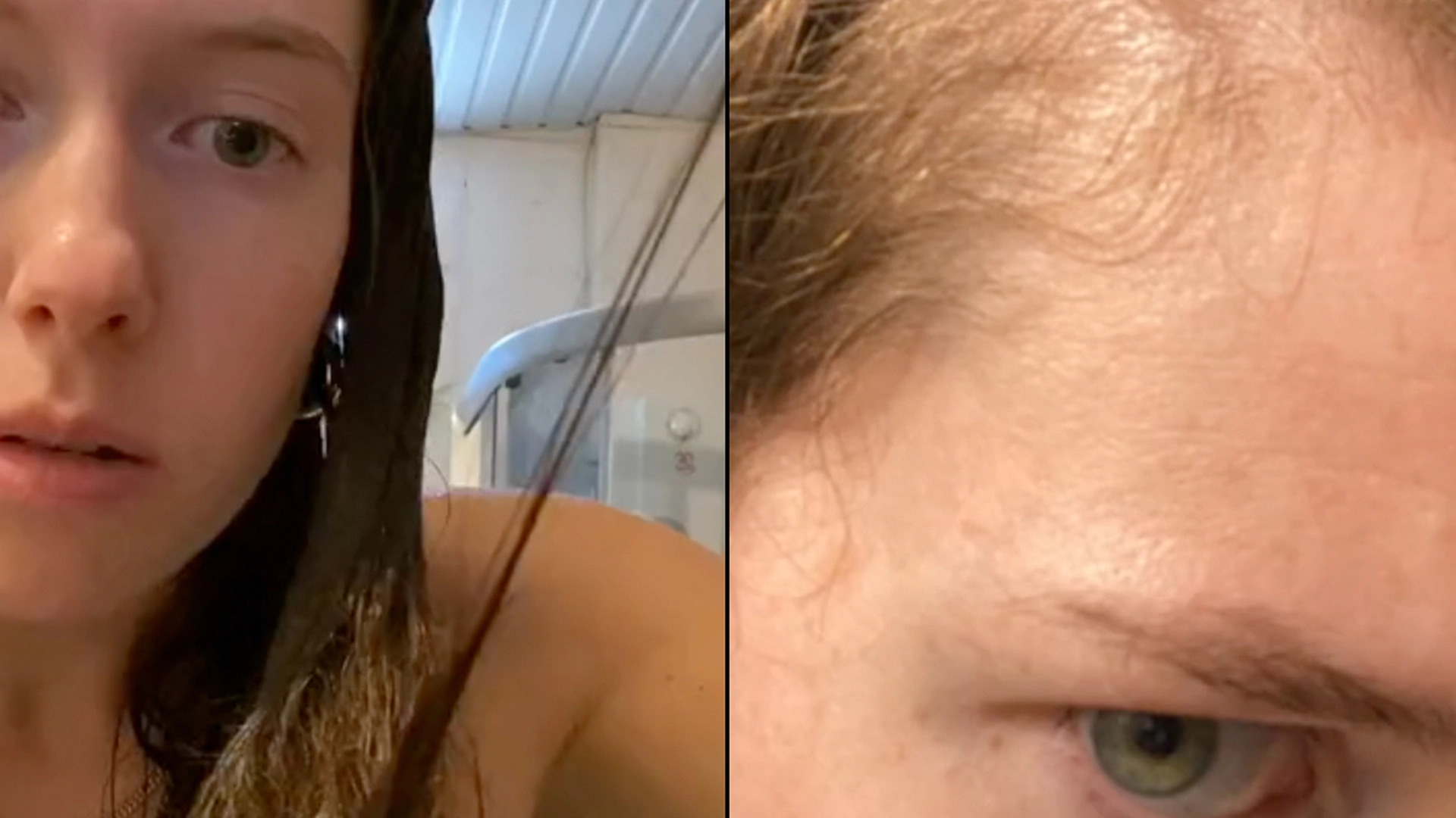 Hendes hår begyndte at falde ud i totter: Men hun fik det hele tilbage ved at lave 4 simple ændringer