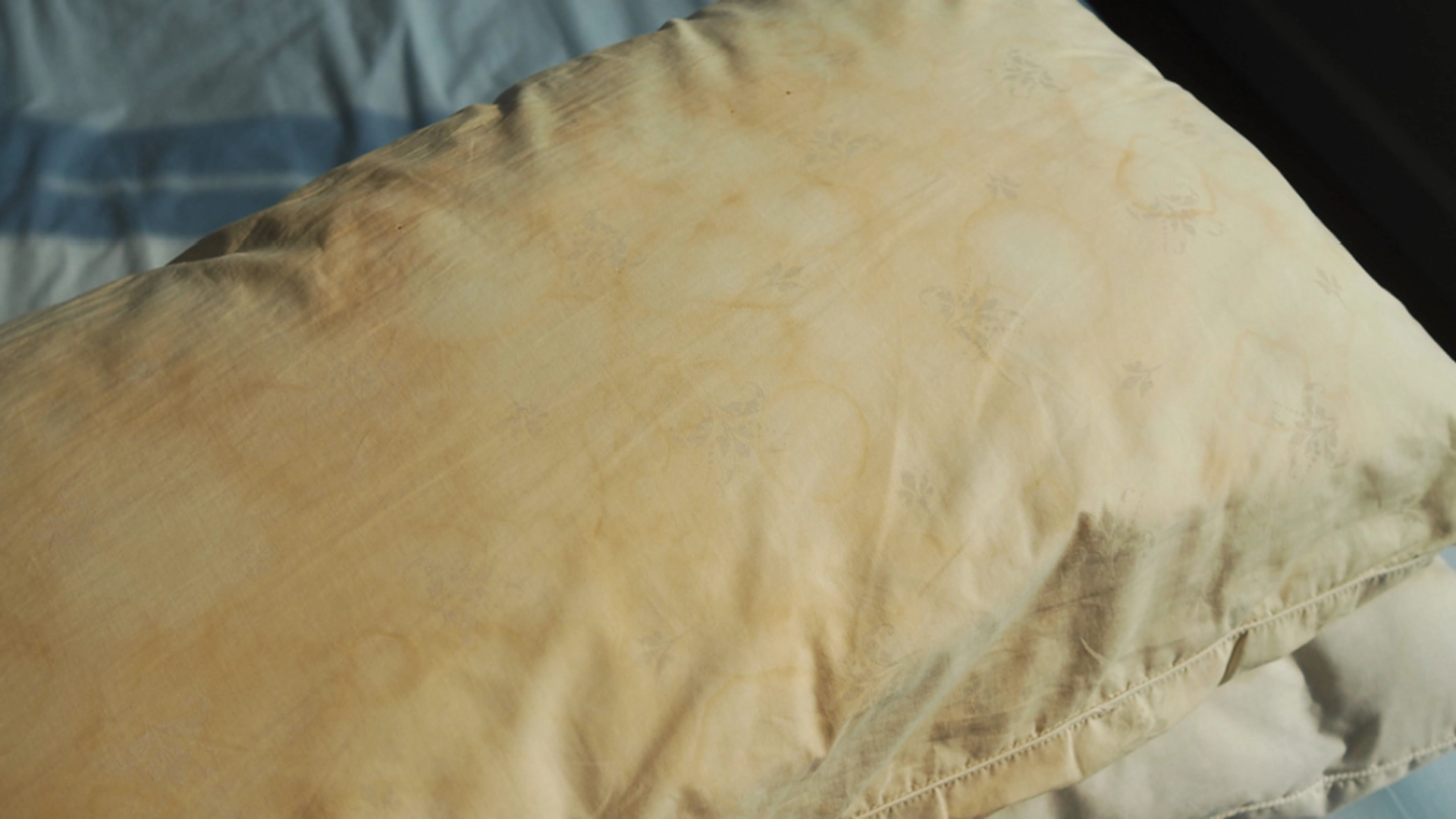 Mange opdager det alt for sent: Gule pletter på puden kan være et faresignal