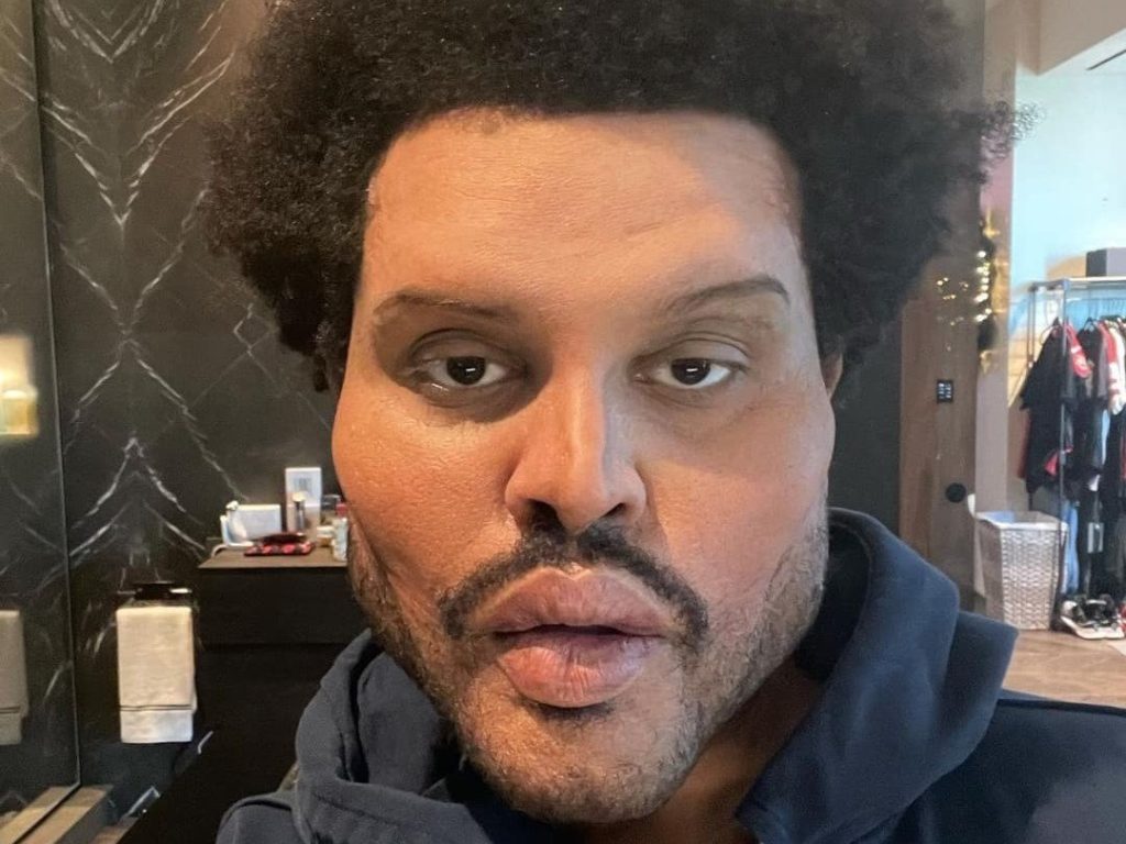 Fans i chok over The Weeknd: Hvad er der sket?