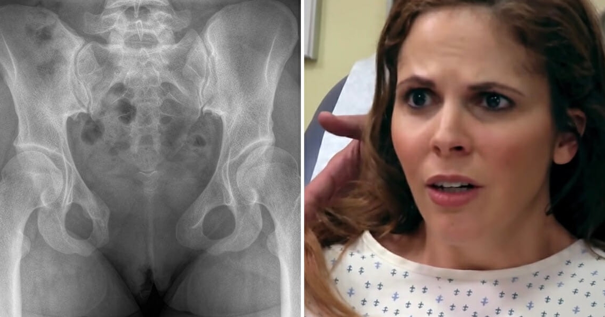 Læge gjorde chokerende fund oppe i kvinde: Kort efter ville manden skilles