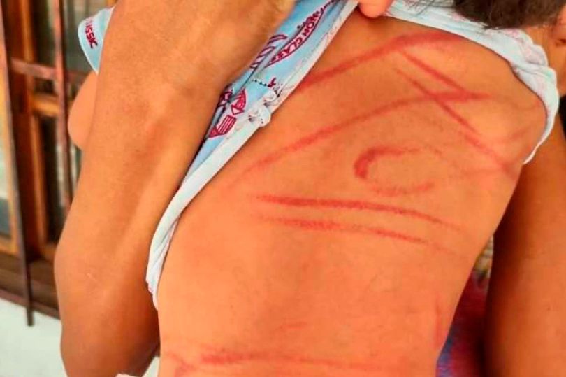 Toårig dreng pisket med metaltråde: Kvinde anholdt