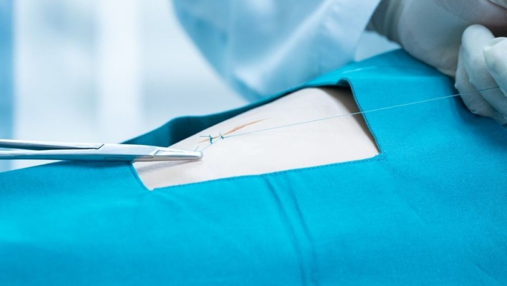 Han stak et hvad op hvor?! Seksuel leg endte i katastrofe for 21-årig mand