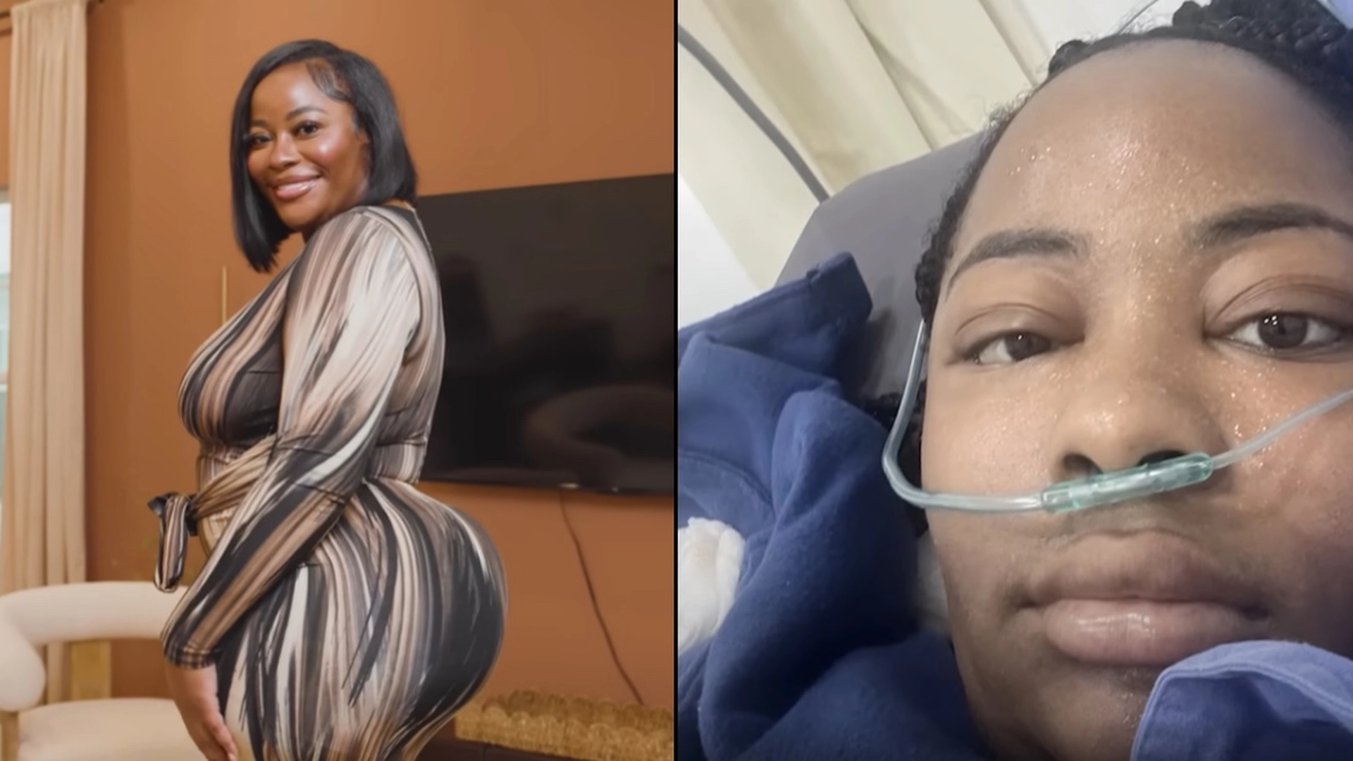 Influencer tog til Mexico for billig numseoperation: Det var tæt på at koste hende livet