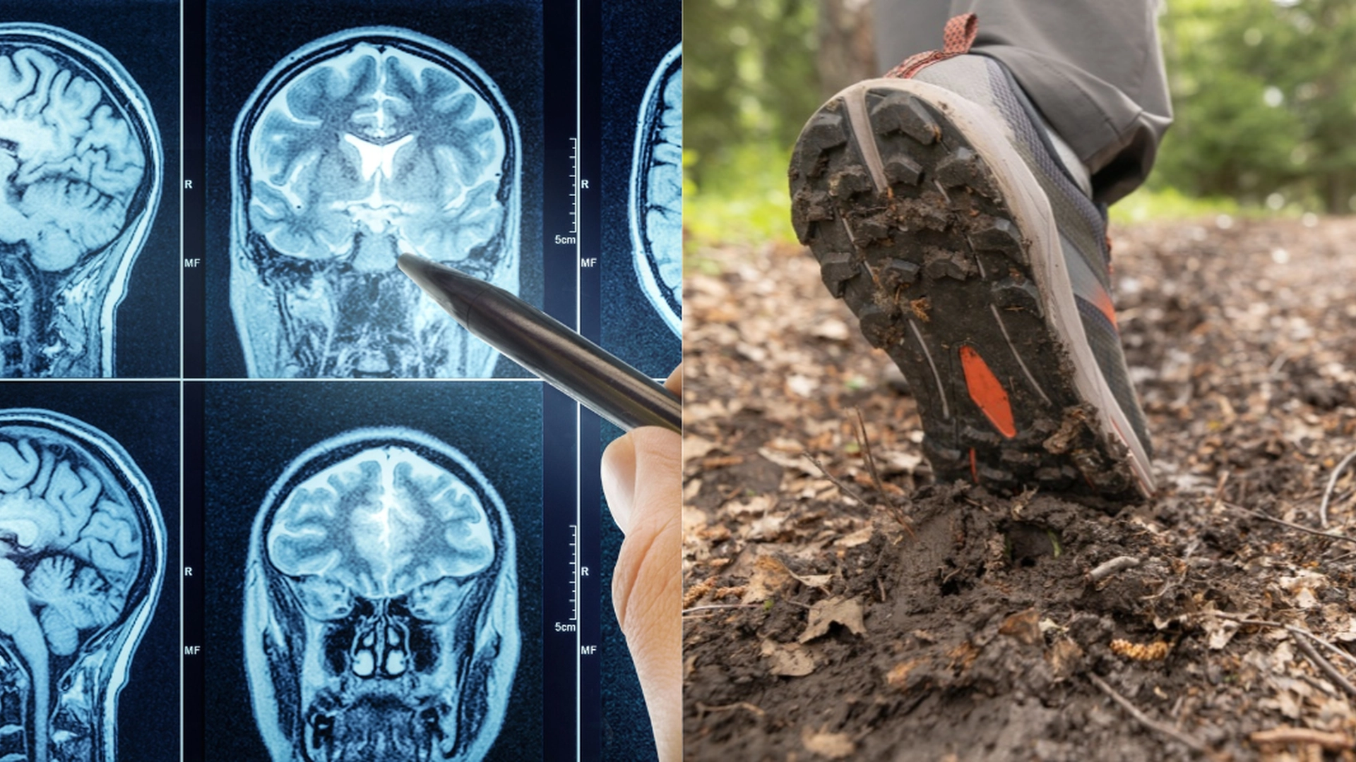 Neurolog gør banebrydende Alzheimers-forskning: Læg mærke til dette, når du går