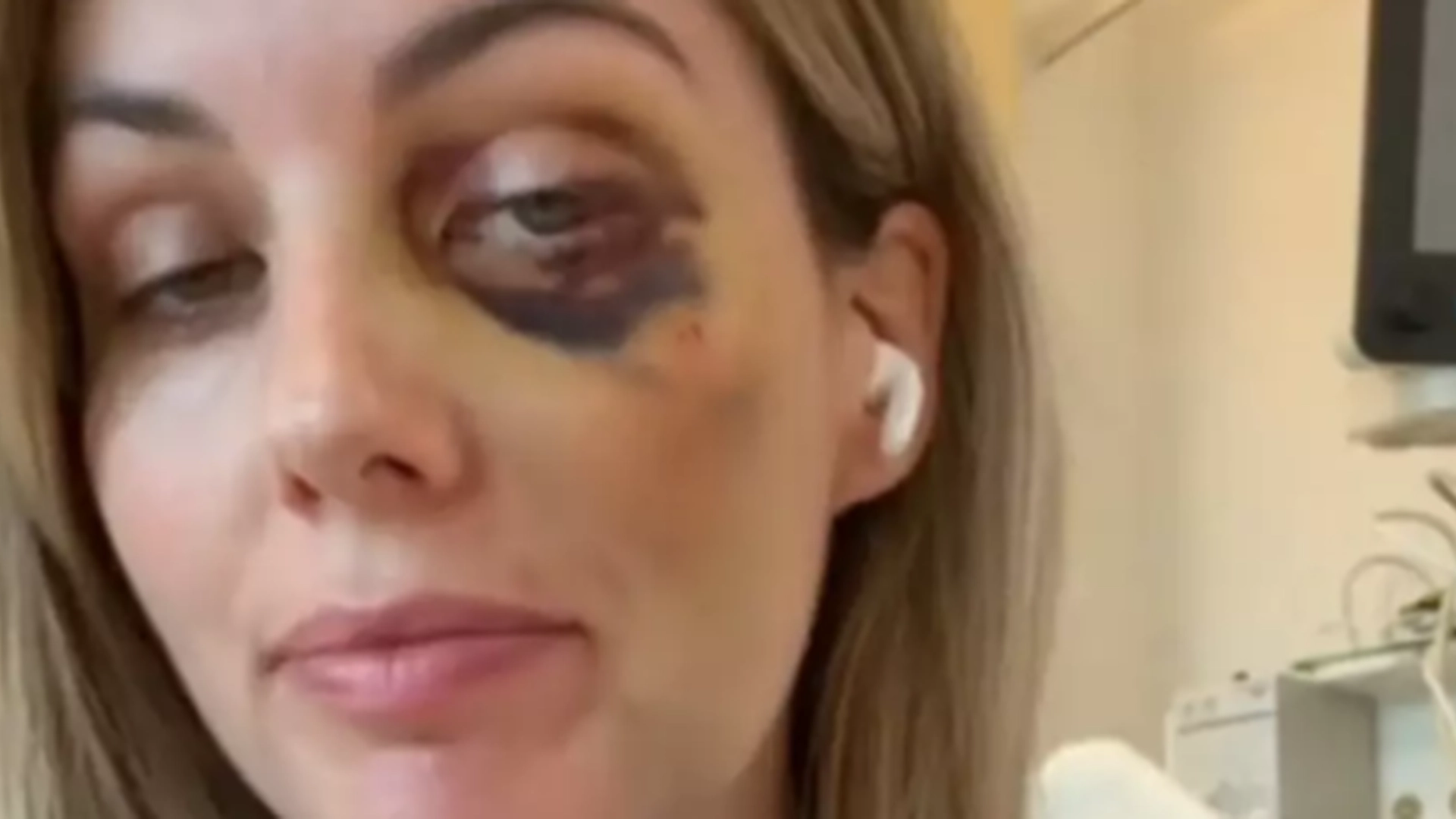 33-årig sund kvinde var tæt på at miste livet under en flyrejse: Nu udsender hun grum advarsel til andre