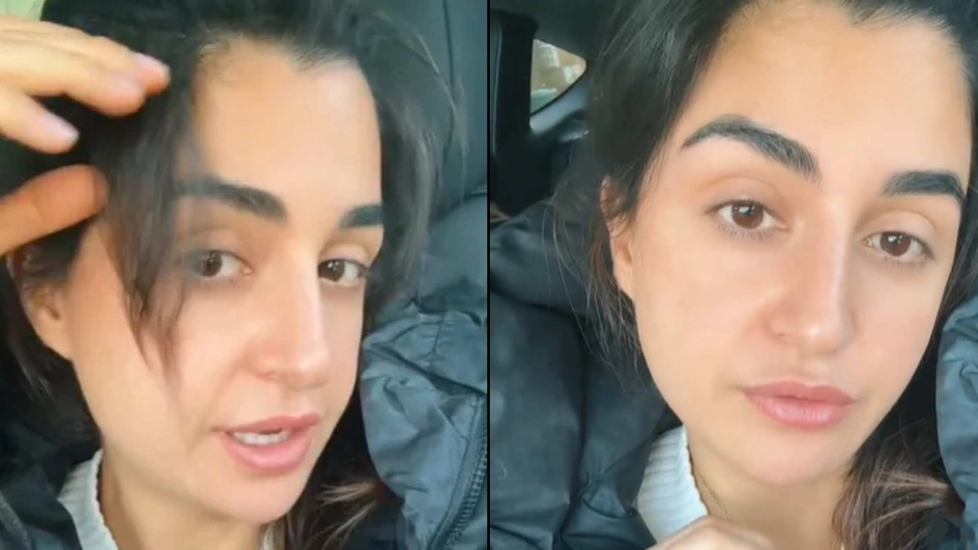 Læge boostede sin hårvækst på blot 1 måned: Her er de 5 ting, du bør spise til morgenmad