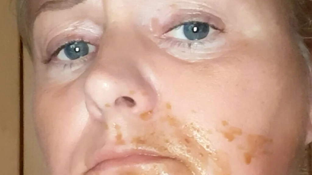 Amanda tog en lur: Vågende op til at hendes hund lagt noget ulækkert i hendes mund