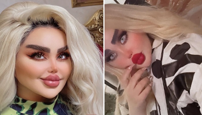 Se billederne: ‘Levende Barbie’-dukke afslører sit nye “ansigt” efter 43 kosmetiske indgreb
