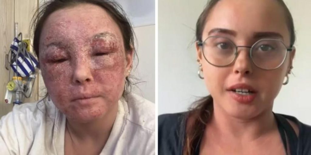 Béatrices rejse til Belgien blev til et mareridt: “Jeg troede, jeg skulle være sådan resten af mit liv”