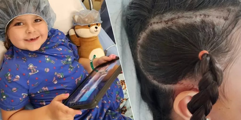Medicinsk mirakel: Læger slukker for hjernehalvdel hos 6-årig pige for at stoppe en invaliderende sygdom