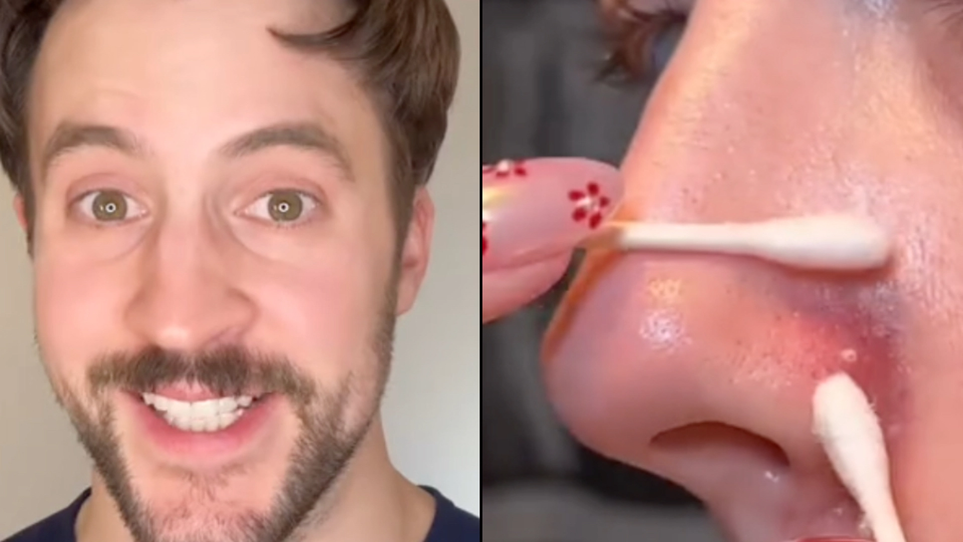 Dermatolog med afsløring: Prik aldrig en bums i dette område