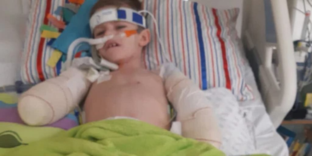En 10-årig fik amputeret arme og ben – da håndværkerne hørte det, tøvede de ikke: “En smuk gestus”