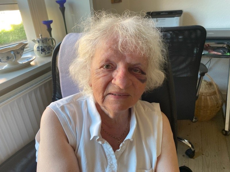 80-årig overfaldet af to på knallert