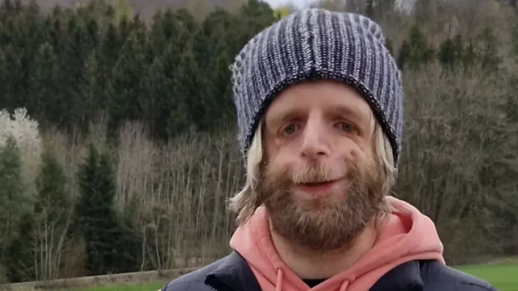 36 timer efter fødslen forlod hans forældre ham: Væmmedes ved hans udseende