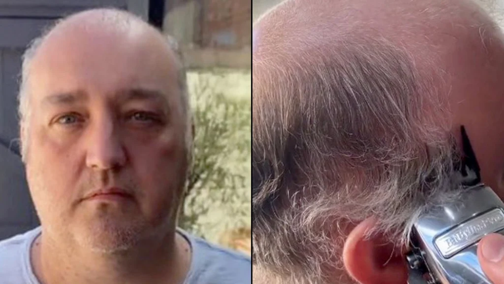 42-årig mand overrasker med vild forvandling: Nu ser han ’20 år yngre ud’