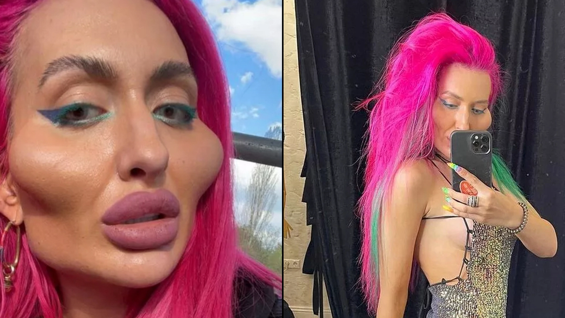 Hun er kendt for at have de ‘største kinder i verden’: Nu viser hun, hvordan hun så ud som 16-årig