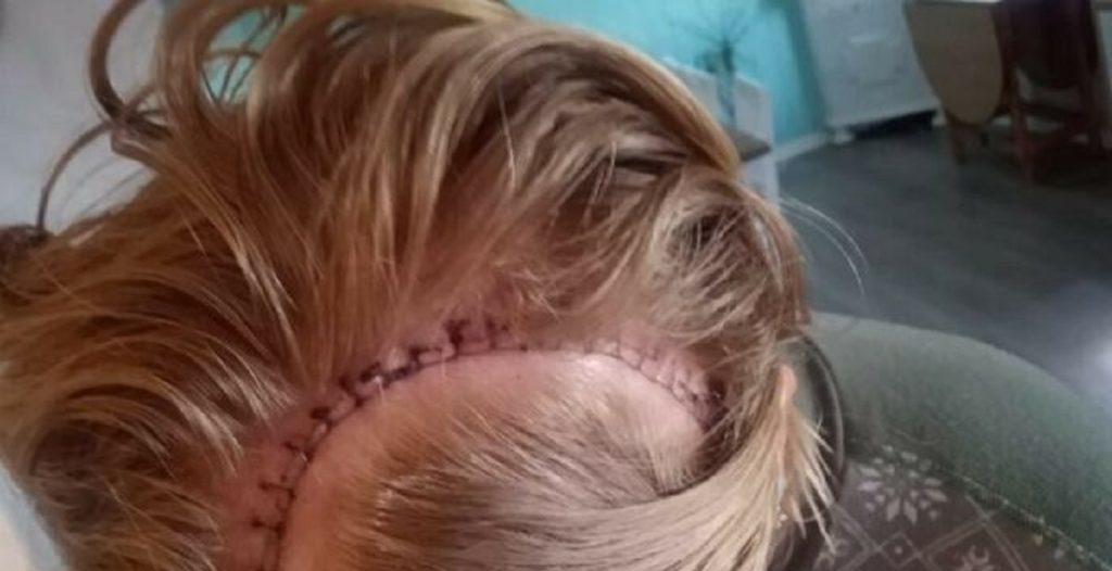 Kristin havde dunkende hovedpine i flere måneder: Så fik hun en chokerende besked