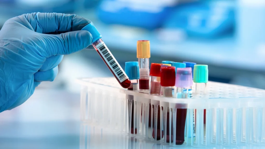 Undersøgelse afslører: Blod fra personer, der lever usædvanligt lang tid, afslører markante forskelle