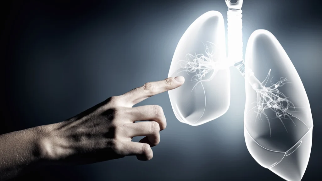 Lungekræft: Usædvanligt tegn der kan opdages tidligt
