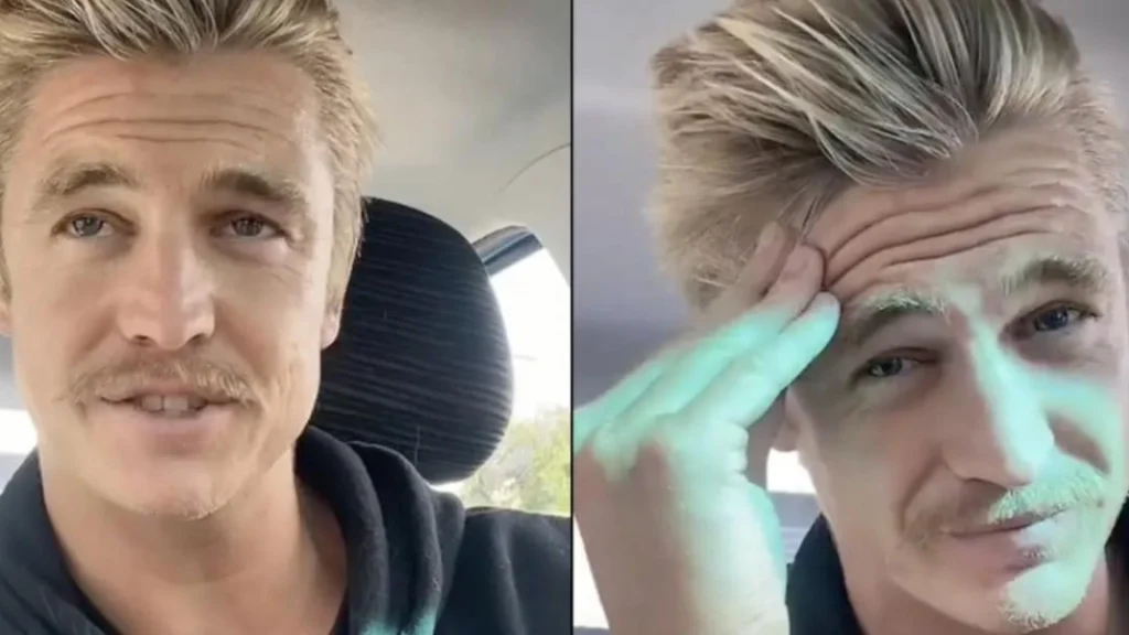 Nick har ikke vasket sit hår i 6 år: Du vil ikke tro dine egne øjne, når du ser det