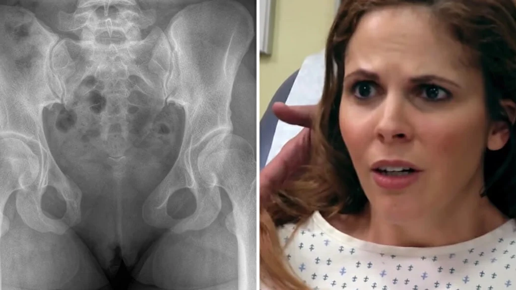 Kvinde klager over smerter i underlivet: Da lægen finder årsagen, vil manden skilles