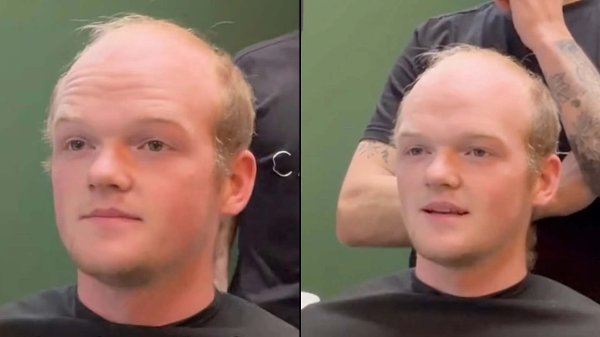 Teenager tabte sit hår: Nu ser han ‘uigenkendelig’ ud efter hårforvandling