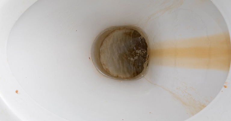 Dette er metoden, hoteller bruger til at fjerne brune pletter fra toilettet