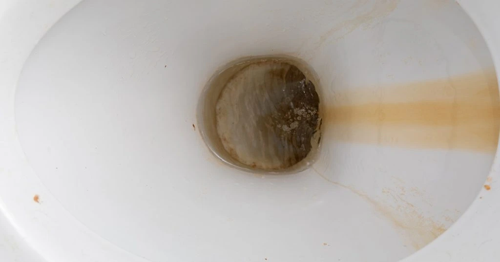 Ekspert afslører: Sådan fjerner du kalk og brune striber i toilettet