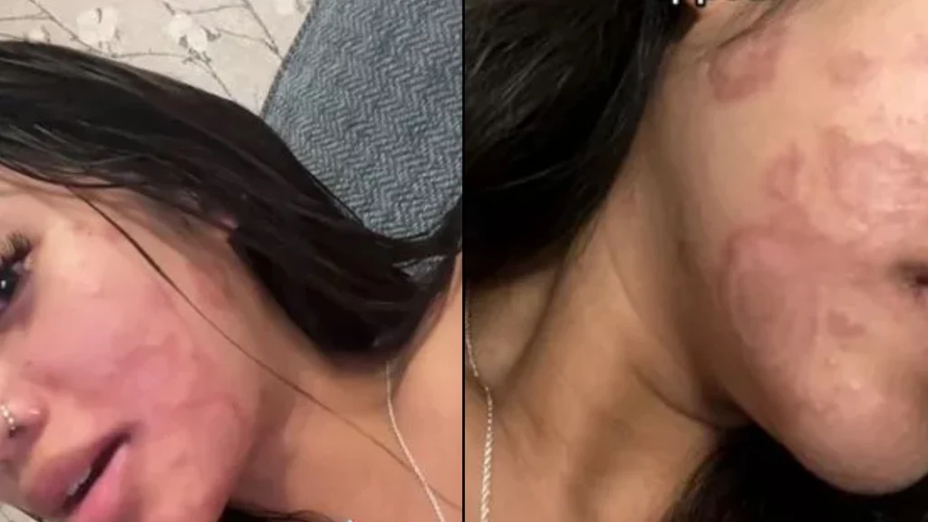 Ung kvinde rengjorde ikke sine makeup-børster efter brug: Det kom hun til at fortryde