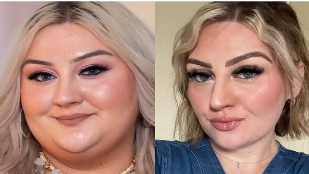 Victoria vejede 171 kilo og tabte sig 85 kilo: Det var starten på helvede for hende