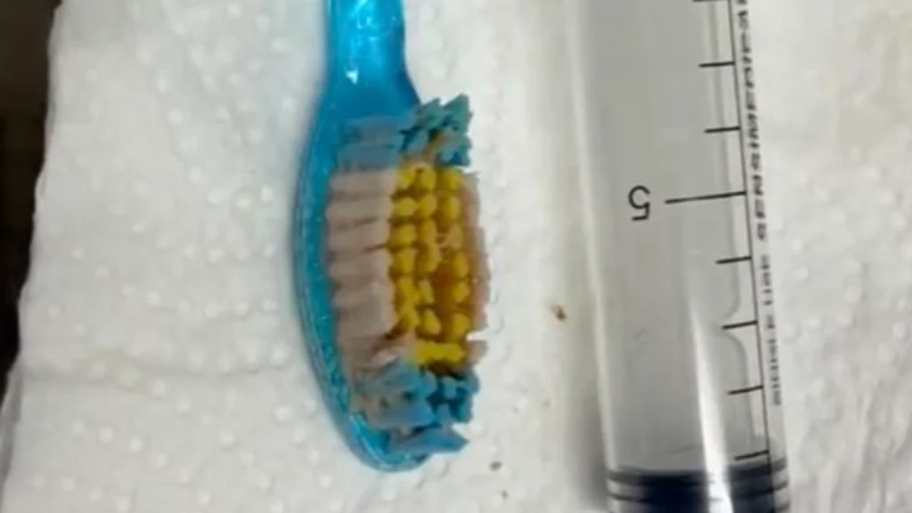 32-årig mand børstede tænder, da ulykken skete: Lægerne havde aldrig set lignende