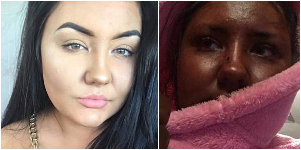 20-årige kvinde testede ny selvbruner: Nu griner alle af hende