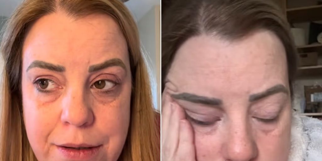 Kvinde troede, at hun var ved at komme i overgangsalderen: Hendes symptomer viste sig at være tegn på noget helt andet