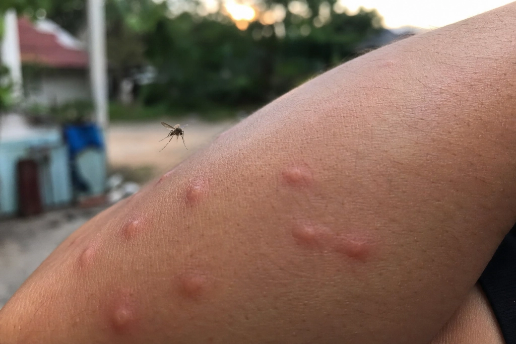 Frankrig har en mygeplage – så de slipper millioner flere myg løs med vilje